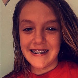 Meet your Posher, Chesney